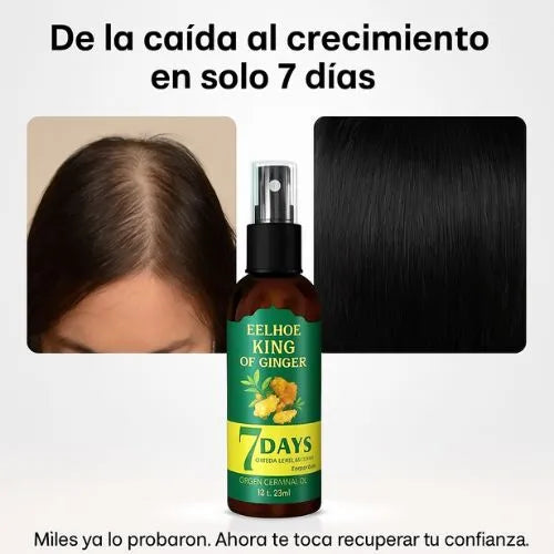 Elimina la caida y aumenta el crecimiento del cabello de forma natural