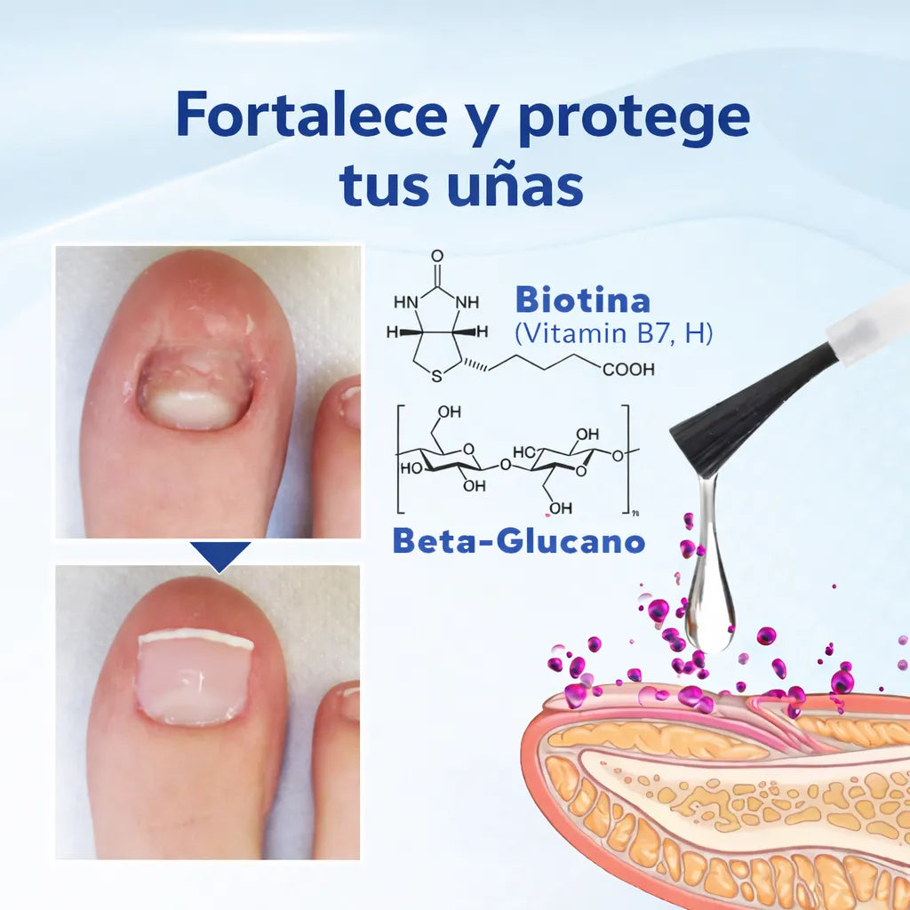 Luce uñas perfectas y saludables en 7 días sin tratamientos dolorosos ni citas médicas