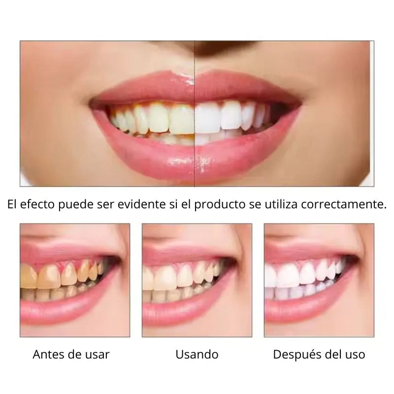 EFERO TEETH WHITENING ESSENCE® - Blanqueador de dientes (60ml)