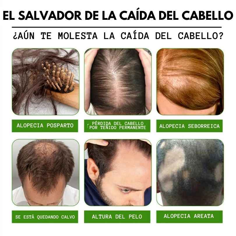 Elimina la caida y aumenta el crecimiento del cabello de forma natural