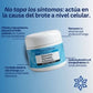 Crema para controlar hongos y cuidar el cuero cabelludo