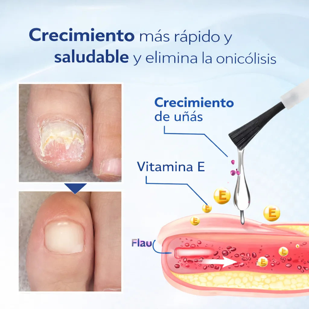 Luce uñas perfectas y saludables en 7 días sin tratamientos dolorosos ni citas médicas
