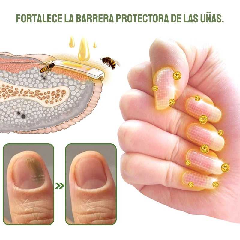 Furzero™ Nail Defense - Uñas Fuertes y Sanas