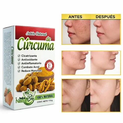 Jabón natural para aclarar manchas, reducir acné y unificar tono