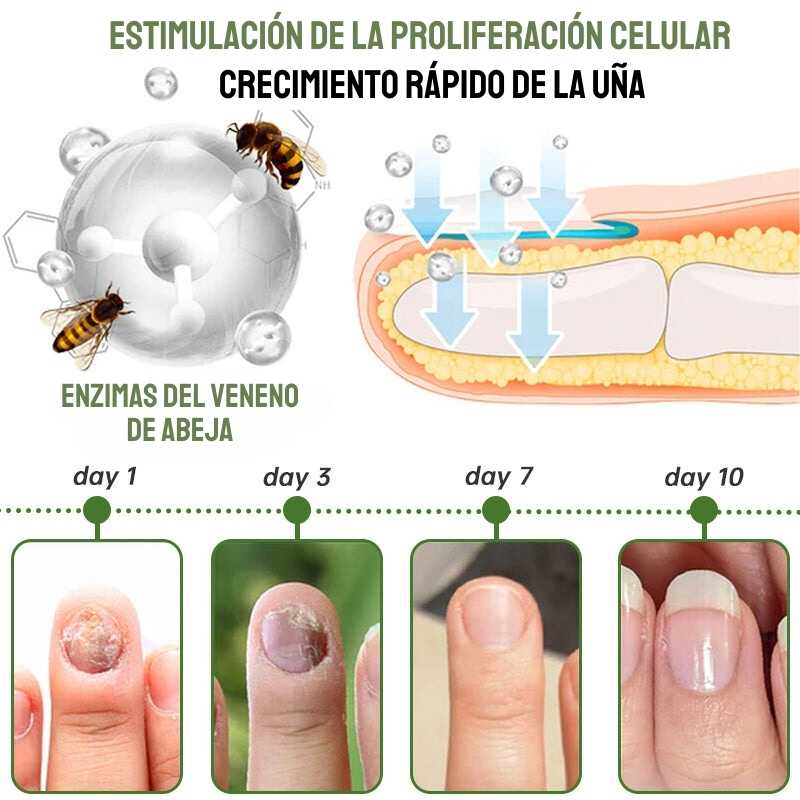 Furzero™ Nail Defense - Uñas Fuertes y Sanas