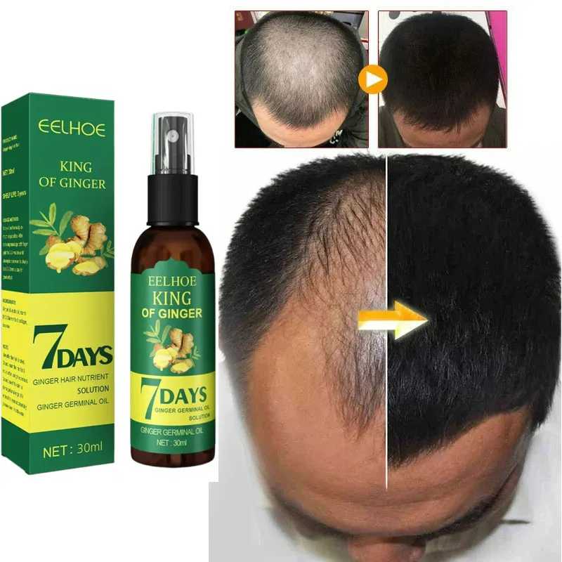 Elimina la caida y aumenta el crecimiento del cabello de forma natural