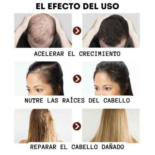 Shampoo Anti Caida y Crecimiento del cabello (100ml)