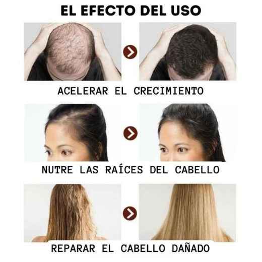 Shampoo Disaar: Anti Caida y Crecimiento del cabello (250ml)