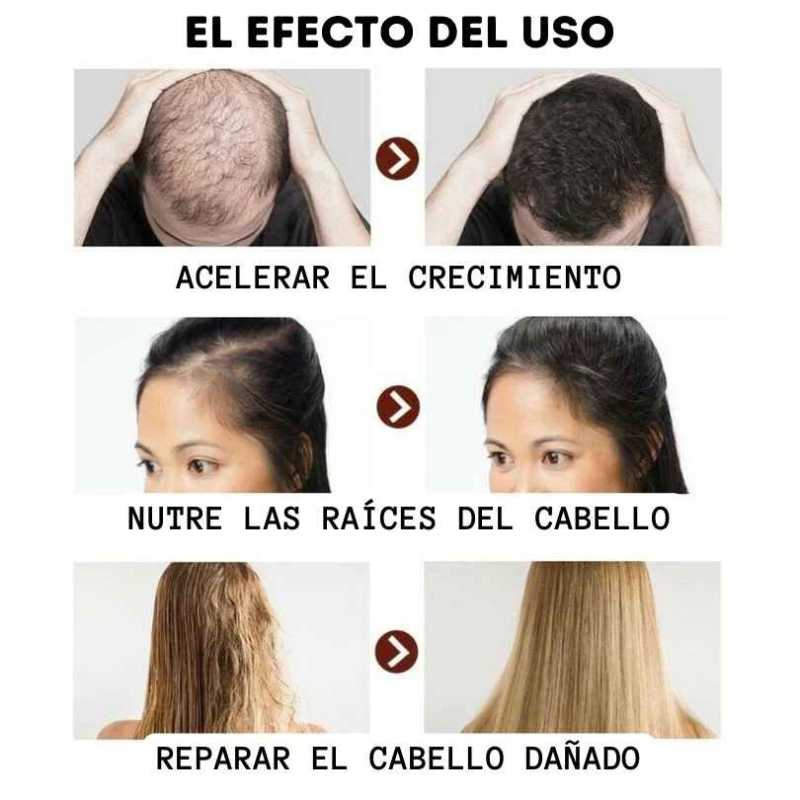 Combo CapilMax® - Fortalece y Renueva Tu Cabello