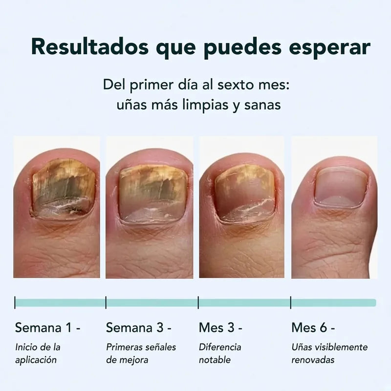 7 Days Fungus Free Nails