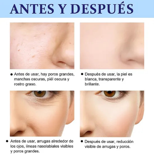 Esencia Reparadora Antiedad (Vitamina E) - Reduce Arrugas, Manchas y Ojeras