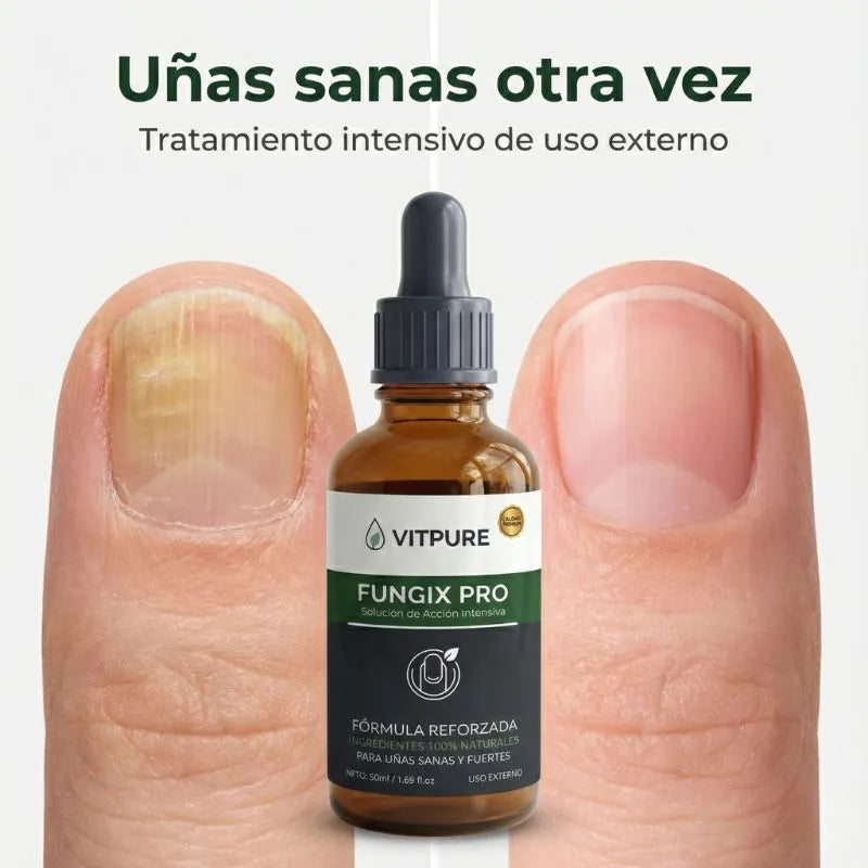 Elimina los hongos de las uñas y las recupéralas fuertes y sanas