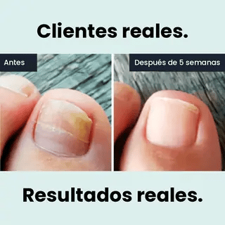 Resultados que puedes esperar